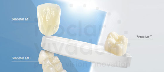 Tampak Alami Semua Veneer Porselen EMAX Dental Crown