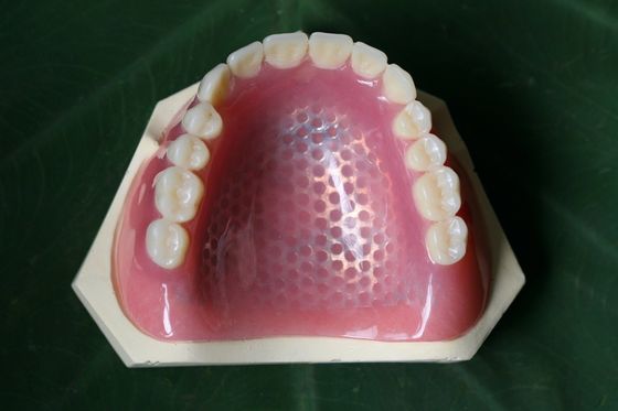 Kerangka Logam Pencetakan 3D Kerangka Logam Gigi Tiruan Sebagian