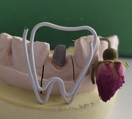 Pos Gigi Logam Dan Inti Setelah Perawatan Endodontik