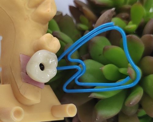 Tingkat Perlengkapan Implan Gigi Single Tooth Trushine OSSETEM