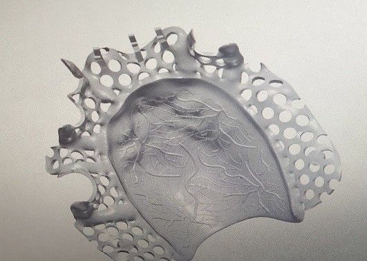 Desain CAD Kerangka Logam Gigi Tiruan Sebagian Paduan Titanium