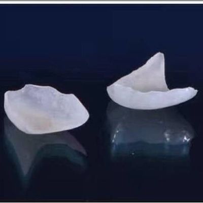 Tampak Alami Semua Veneer Porselen EMAX Dental Crown