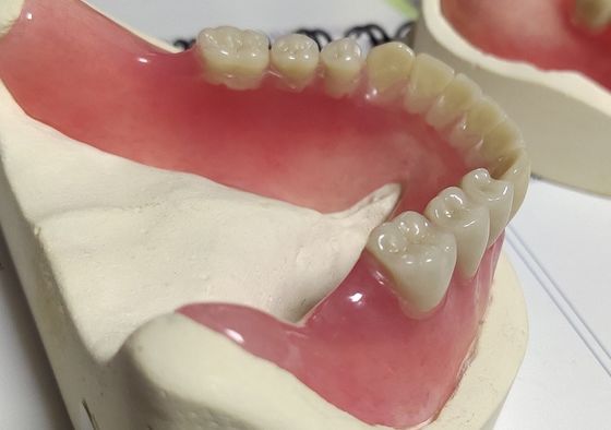 Esthetics Full Denture Cold Cured Acrylic Partial Denture