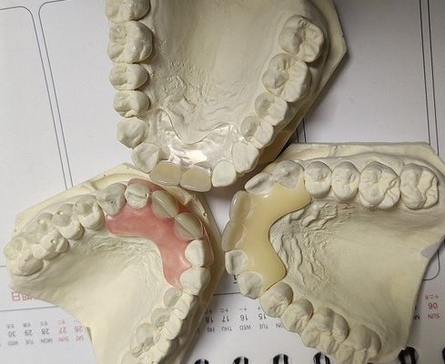 Gigi Tiruan Tak Terlihat Valplast Lembut Dan Elastis Sementara
