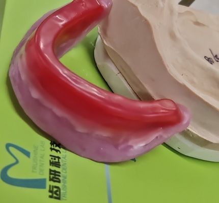 Blok Rekam Gigi Trushine Untuk Gigi Tiruan Lengkap Akhir