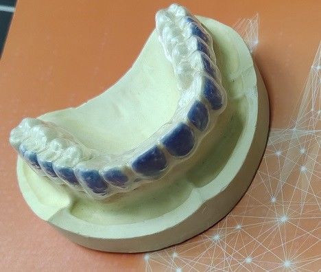 ISO13485 Teeth Whitening Bleach Guard Untuk Noda Asap