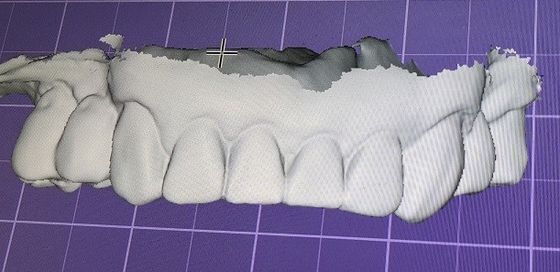 3D Digital Mock Up Teeth Produk Gigi Lainnya