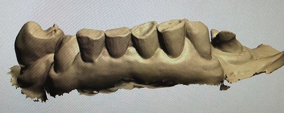 3D Digital Mock Up Teeth Produk Gigi Lainnya