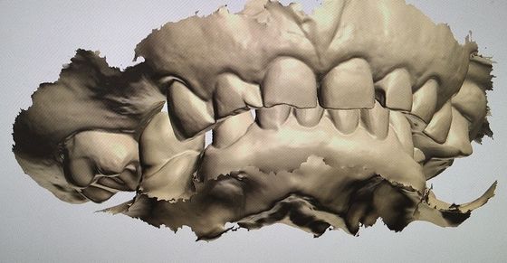 Desain CAD CAM Tampilan Digital Mockup Teeth Produk Gigi Lainnya