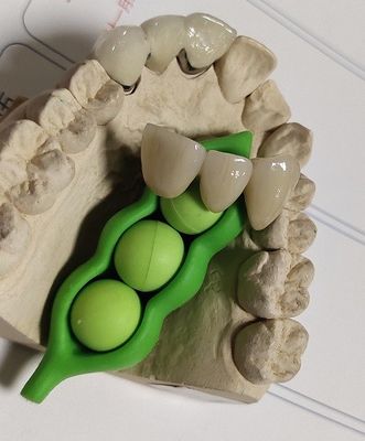 Desain Cetak 3D Gigi CAD CAM
