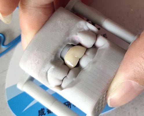 Laboratorium PFM Dental Crown 3D printing Bridge Dental Crown