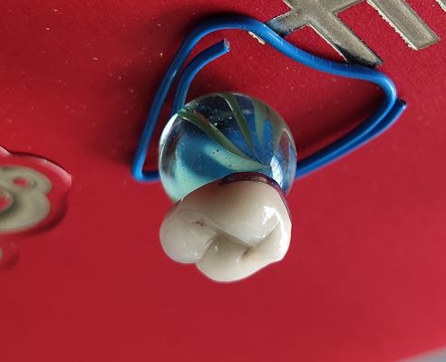 Produk Lab Gigi CAD CAM PFM Mahkota porselen menyatu dengan logam