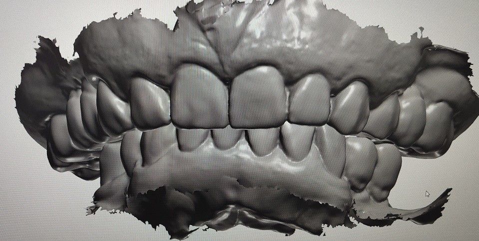 Desain CAD CAM Tampilan Digital Mockup Teeth Produk Gigi Lainnya