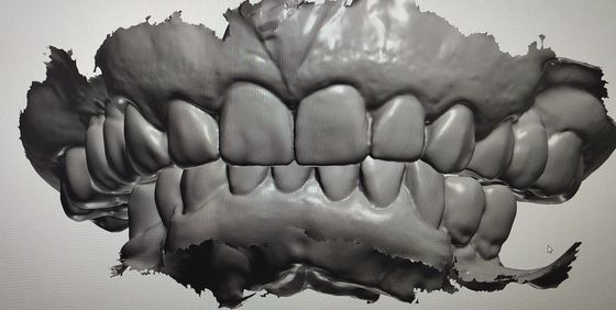 Desain CAD CAM Tampilan Digital Mockup Teeth Produk Gigi Lainnya