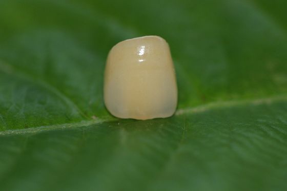 Laboratorium Desain Gigi Keramik Penuh ISO13485 Zirkonia Dental Crown Untuk Gigi Anterior